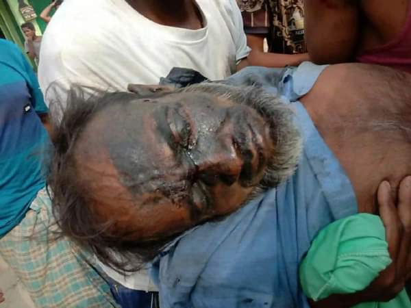 নাইক্ষ্যংছড়ি সীমান্তে মাইন বিস্ফোরণে উড়ে গেল এক কাঠুরিয়ার পায়ের গোড়ালি 
