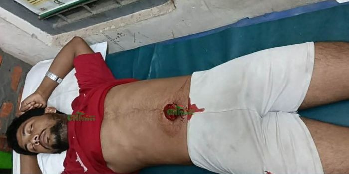 নানিয়ারচরে ফুফাতো ভাইকে ছুরিকাঘাত, আশঙ্কাজনক যুবক